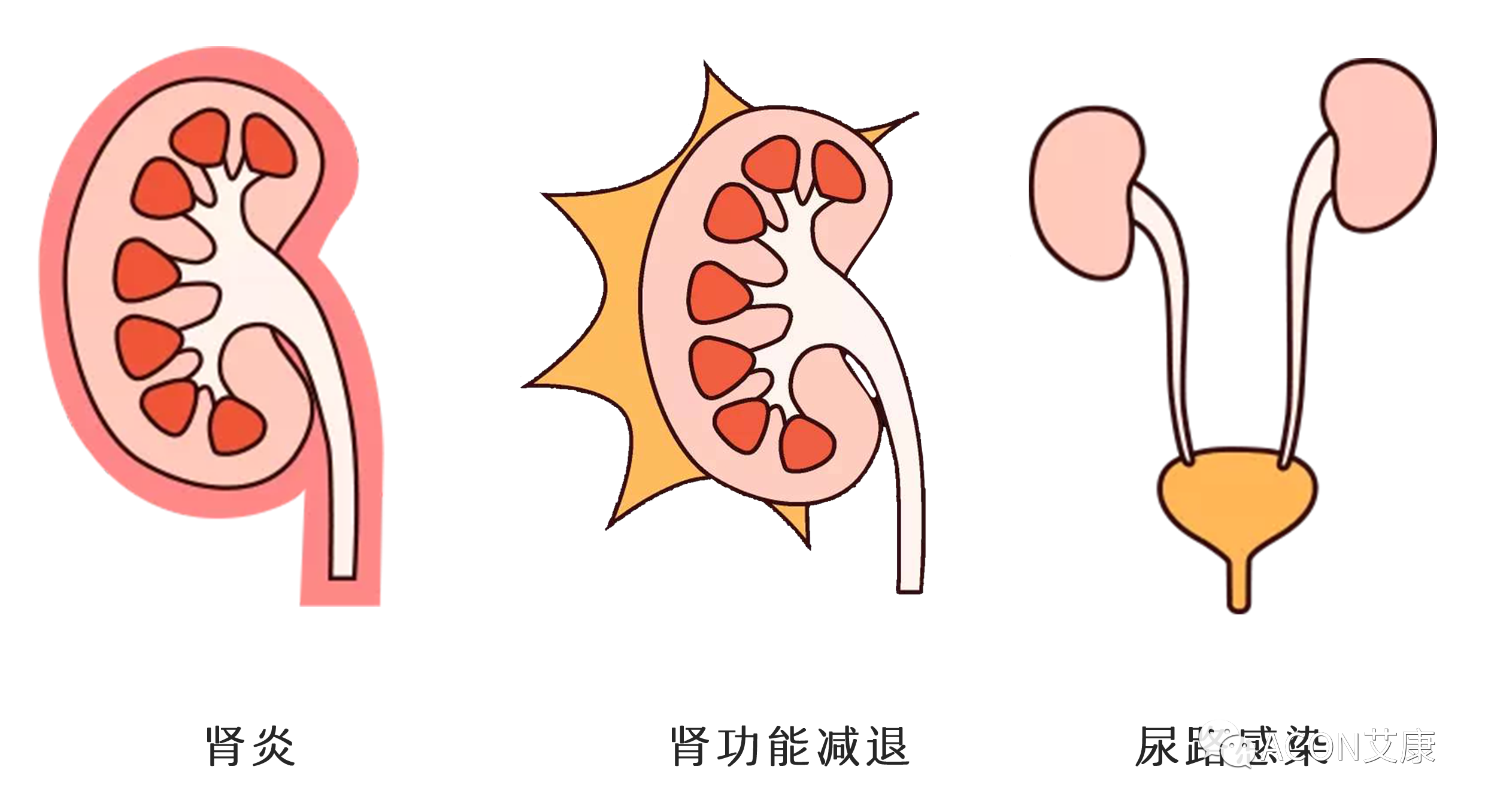 排尿黄、异味大，可能是身体在报警！