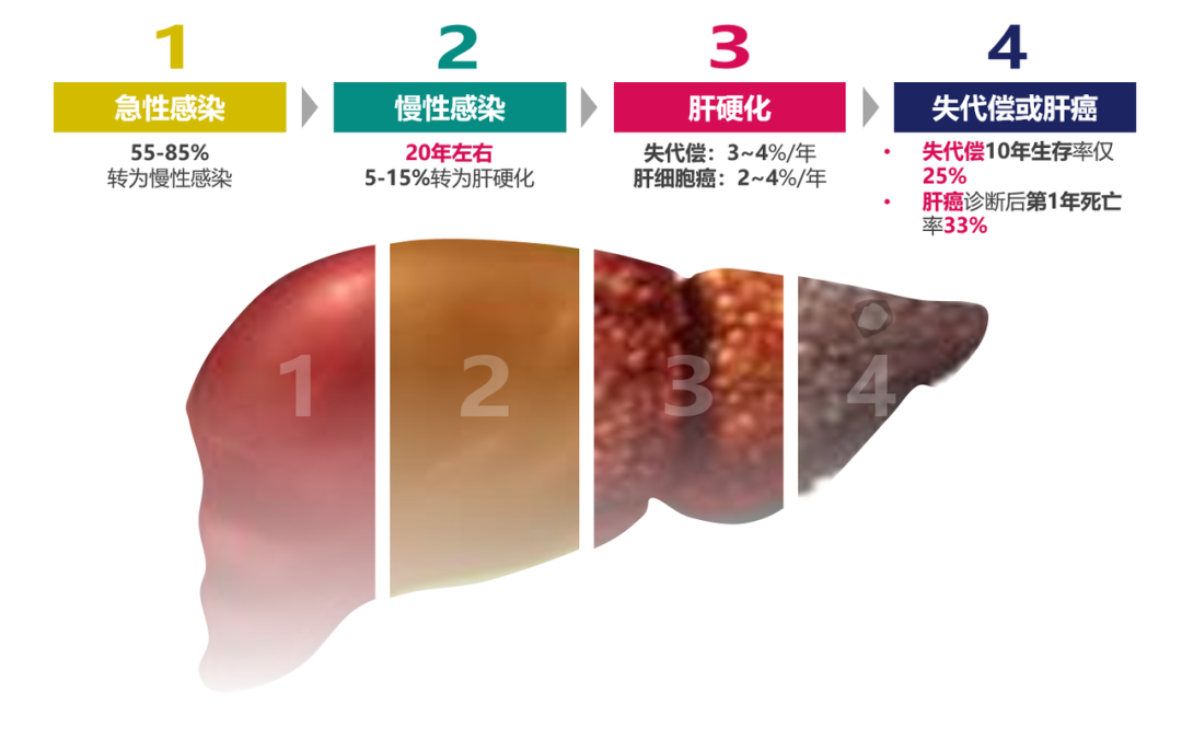 悄悄变成肝硬化、肝癌，很多人感染了却不知道